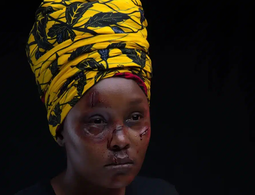 How CWCD is using tech to effect social change in Nigeria 3 An African woman with bruises on her face.